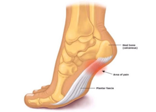 Douleur aux pieds et orthésiste!